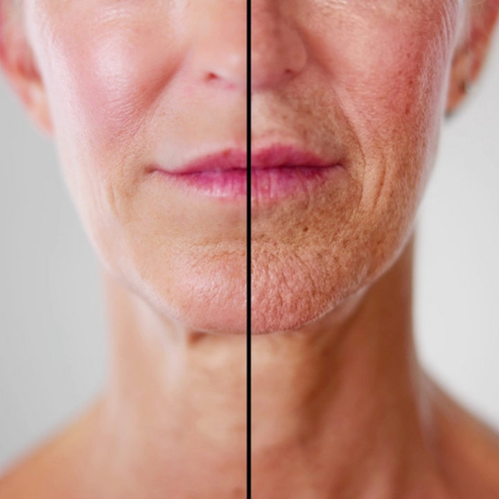 5 Ways To Rejuvenate Your Skin